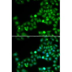 DNA Polymerase Kappa (POLK) Antibody