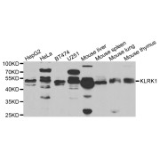 Western blot analysis of extracts of various cell lines, using KLRK1 antibody (abx004687) at 1/1000 dilution.