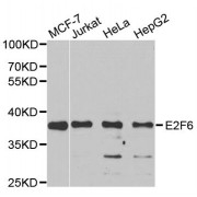 Western blot analysis of extracts of various cell lines, using E2F6 antibody (abx004706) at 1/1000 dilution.