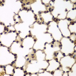 E2F Transcription Factor 6 (E2F6) Antibody