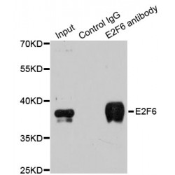 E2F Transcription Factor 6 (E2F6) Antibody