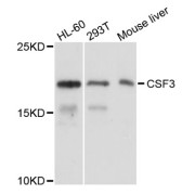 Western blot analysis of extracts of various cell lines, using CSF3 antibody (abx004722) at 1/1000 dilution.