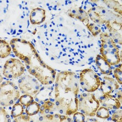 Catechol O-Methyltransferase (COMT) Antibody