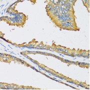 Immunohistochemistry of paraffin-embedded human prostate using CXCL11 antibody (abx004738) at dilution of 1/100 (40x lens).