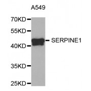 Western blot analysis of extracts of A-549 cells, using SERPINE1 antibody (abx004746) at 1/1000 dilution.