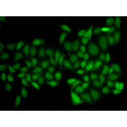 Ataxin 1 (ATXN1) Antibody