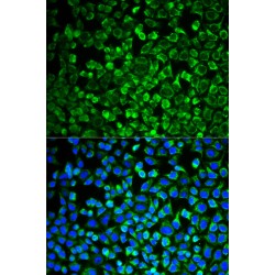 GRB2-Associated-Binding Protein 1 (GAB1) Antibody