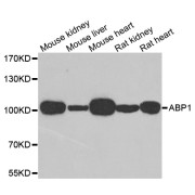 Western blot analysis of extracts of various cell lines, using AOC1 antibody (abx004771) at 1/1000 dilution.