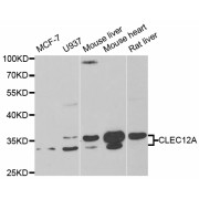 Western blot analysis of extracts of various cell lines, using CLEC12A antibody (abx004772) at 1/1000 dilution.