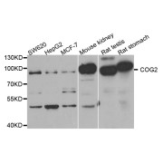 Western blot analysis of extracts of various cell lines, using COG2 antibody (abx004773) at 1/1000 dilution.