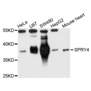 Western blot analysis of extracts of various cell lines, using SPRY4 antibody (abx004783) at 1/1000 dilution.