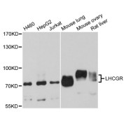 Western blot analysis of extracts of various cell lines, using LHCGR antibody (abx004786) at 1/1000 dilution.