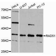 Western blot analysis of extracts of various cell lines, using RAD51 antibody (abx004788) at 1/1000 dilution.