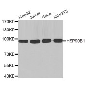 Western blot analysis of extracts of various cell lines, using HSP90B1 antibody (abx004792).