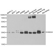 Western blot analysis of extracts of various cell lines, using ANXA4 antibody (abx004799) at 1/1000 dilution.