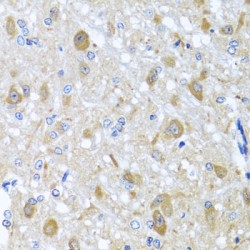 BCL2/Adenovirus E1B 19 kDa Protein-Interacting Protein 3-Like (BNIP3L) Antibody