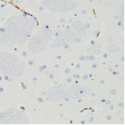 Immunohistochemistry of paraffin-embedded mouse brain using GALT antibody (abx004808) at dilution of 1/100 (40x lens).