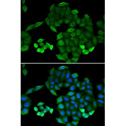 6-Pyruvoyl Tetrahydrobiopterin Synthase (PTS) Antibody