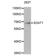 Western blot analysis of extracts of 293T cells, using SOAT1 antibody (abx004824).