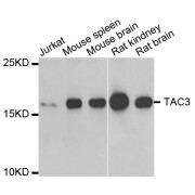 Western blot analysis of extracts of various cell lines, using TAC3 antibody (abx004825) at 1/1000 dilution.