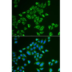 Tachykinin-3 (TAC3) Antibody