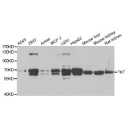 Western blot analysis of extracts of various cell lines, using TKT antibody (abx004826) at 1/1000 dilution.