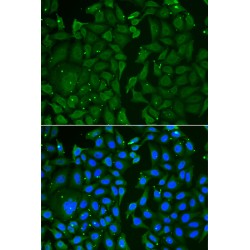 Transketolase (TKT) Antibody