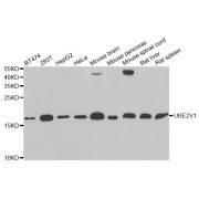 Western blot analysis of extracts of various cell lines, using UBE2V1 antibody (abx004828) at 1/1000 dilution.