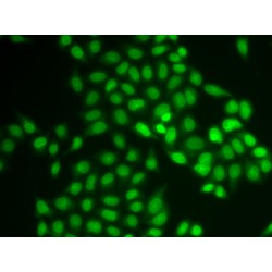 Ubiquitin-Conjugating Enzyme E2 Variant 1 (UBE2V1) Antibody