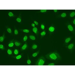 Ubiquitin-Conjugating Enzyme E2 Variant 1 (UBE2V1) Antibody