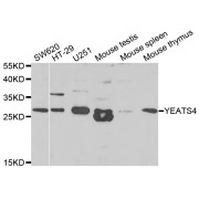 Western blot analysis of extracts of various cell lines, using YEATS4 antibody (abx004830) at 1/1000 dilution.