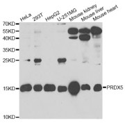 Western blot analysis of extracts of various cell lines, using PRDX5 antibody (abx004837) at 1/1000 dilution.