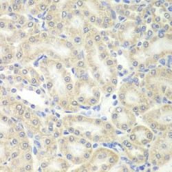 Peroxiredoxin 5 (PRDX5) Antibody