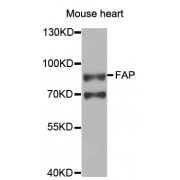 Western blot analysis of extracts of mouse heart, using FAP antibody (abx004852) at 1/1000 dilution.