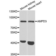 Western blot analysis of extracts of various cell lines, using AMPD3 antibody (abx004856) at 1/1000 dilution.