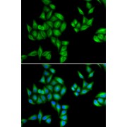 Immunofluorescence analysis of HeLa cells using BTG1 antibody (abx004860). Blue: DAPI for nuclear staining.