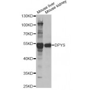 Western blot analysis of extracts of various cell lines, using DPYS antibody (abx004868) at 1/1000 dilution.