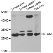 Western blot analysis of extracts of various cell lines, using STOM antibody (abx004872) at 1/1000 dilution.