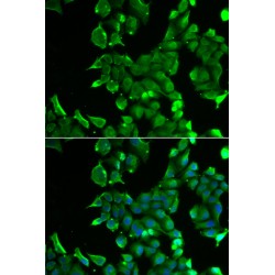 Stomatin (STOM) Antibody