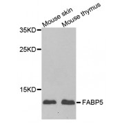 Western blot analysis of extracts of various cell lines, using FABP5 antibody (abx004873) at 1/1000 dilution.