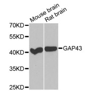 Western blot analysis of extracts of various cell lines, using GAP43 antibody (abx004876) at 1/1000 dilution.