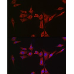 Mitochondrial Peptide Methionine Sulfoxide Reductase (MSRA) Antibody