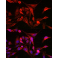 Mitochondrial Peptide Methionine Sulfoxide Reductase (MSRA) Antibody