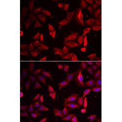 Serpin B9 (SERPINB9) Antibody