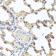 Immunohistochemistry of paraffin-embedded rat lung using PIP antibody (abx004889) at dilution of 1/100 (40x lens).