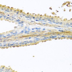 Prolactin-Inducible Protein (PIP) Antibody