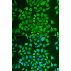 Prolactin-Inducible Protein (PIP) Antibody