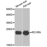 Western blot analysis of extracts of various cell lines, using RCVRN antibody (abx004898) at 1/1000 dilution.