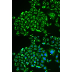 Recoverin (RCVRN) Antibody