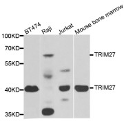 Western blot analysis of extracts of various cell lines, using TRIM27 antibody (abx004899) at 1/1000 dilution.